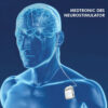 Neuroestimulador ACTIVA SC | Medtronic - Imagen 2