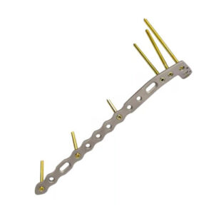 Placas para Tibia Distal y Proximal | Nacional