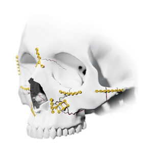 Maxilofacial | Nacional e Importado
